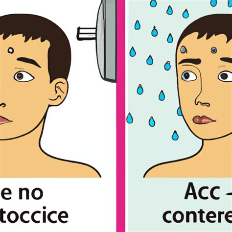do cold showers help acne|11 Benefits of Cold Showers on Acne an.